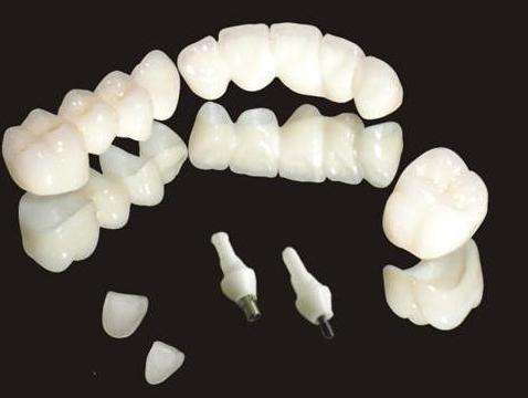 MIM注射成型陶瓷牙 MIM注射成型陶瓷牙